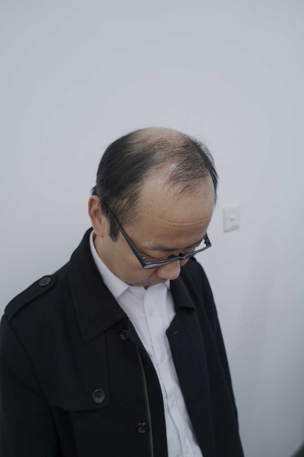 脱发素材 男性 25
