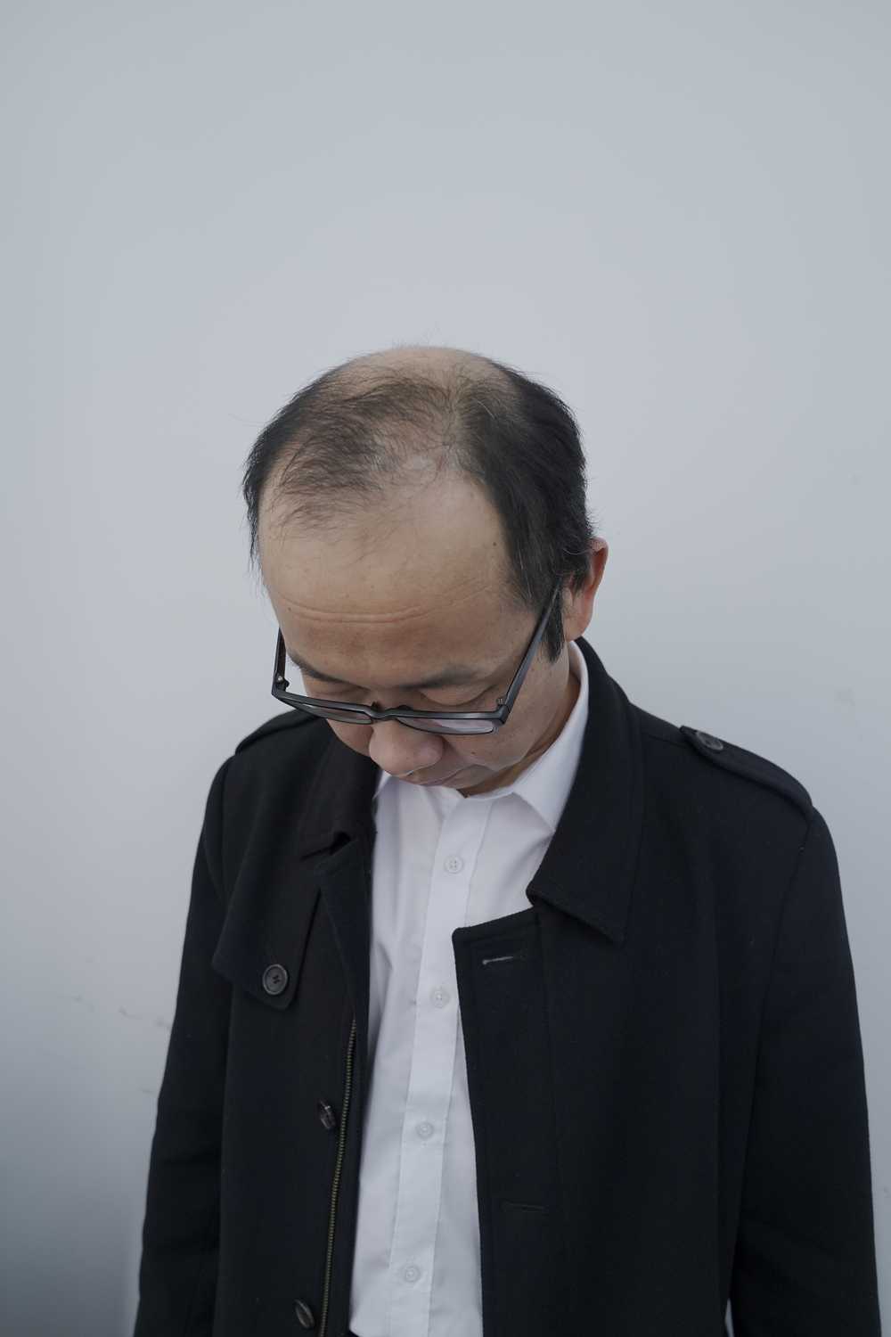 脱发素材 男性 26
