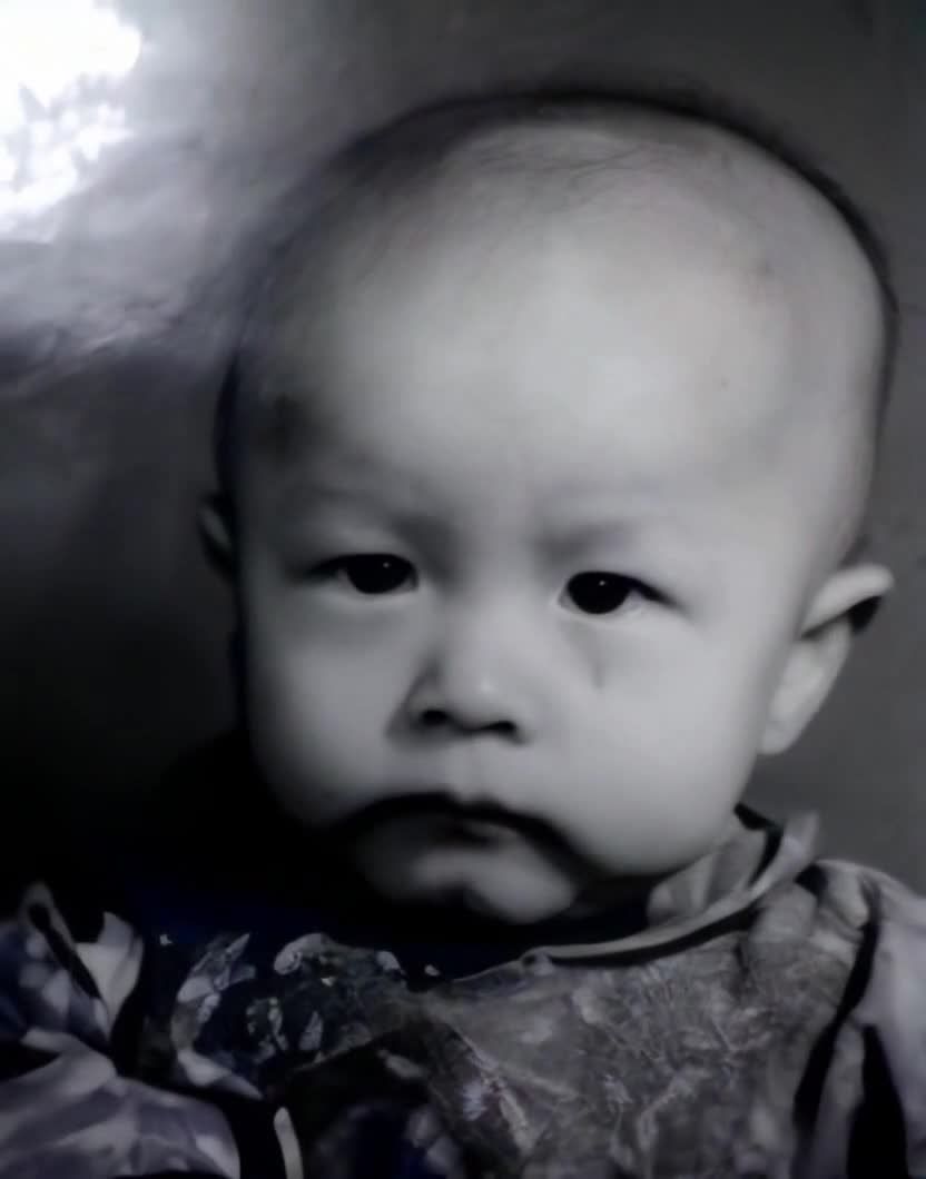 黑白婴儿肖像，额头有斑点，表情严肃。